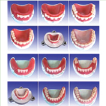 全口牙制作步驟模型