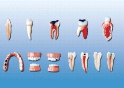 牙齒病變系列模型YR-L1012