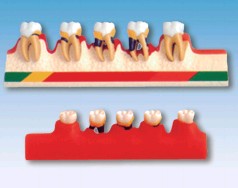 牙周病分類模型YR-L1010
